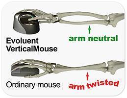 Evoluent Mouse Evoluent VerticalMouse 4 Left